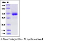 Sino Biological Recombinant Rat ACVR1 Protein (hFc Tag), Quantity: Each