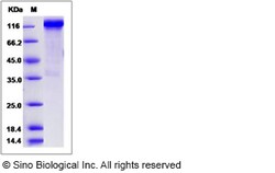 Sino Biological Recombinant Rat ERBB4/Her4 Protein (hFc Tag), Quantity: