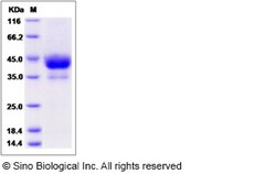 Sino Biological Recombinant Rat ALK4/ACVR1B Protein (hFc Tag), Quantity: