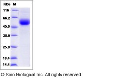 Sino Biological Recombinant Rat TGF-beta RII/TGFBR2 Protein (hFc Tag),