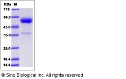 Sino Biological Rat CD153 / CD30L / TNFSF8 Protein (Fc Tag) 100ug, Quantity: