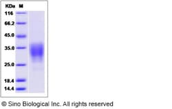 Sino Biological Recombinant Rat CD30 Ligand/TNFSF8 Protein, Quantity: Each