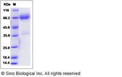 Sino Biological Rat CXCL16 / SR-PSOX Protein (Fc Tag) 50ug, Quantity: Each