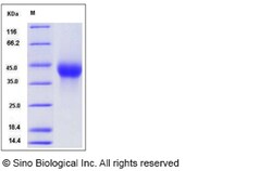 Sino Biological Recombinant Rat CXCL16 Protein (His Tag), Quantity: Each