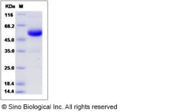 Sino Biological Recombinant Rat CD40/TNFRSF5 Protein (hFc Tag), Quantity: