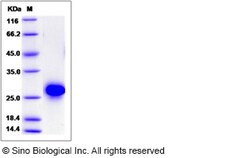 Sino Biological Recombinant Rat CD40/TNFRSF5 Protein (His Tag), HPLC-verified,