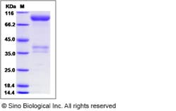 Sino Biological Rat TNFRSF21 / DR6 Protein (Fc Tag) 50ug, Quantity: Each
