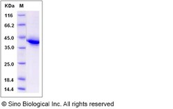 Sino Biological Recombinant Rat BCMA Protein (hFc Tag), Quantity: Each