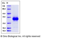 Sino Biological Recombinant Rat RANK/TNFRSF11A Protein (His Tag), Quantity: