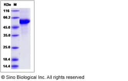 Sino Biological Rat CD70 / CD27L / TNFSF7 Protein (Fc Tag) 100ug, Quantity: