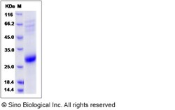 Sino Biological Recombinant Rat CD70/CD27 Ligand Protein (His Tag), Quantity: