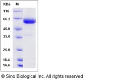 Sino Biological Rat 4-1BBL / CD137L / TNFSF9 Protein (Fc Tag) 50ug, Quantity: