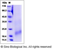 Sino Biological Recombinant Rat BAFFR/TNFRSF13C Protein (His Tag), Quantity:
