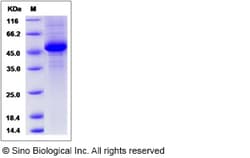 Sino Biological Rat IFNA4 / IFNα4 / Interferon alpha-4 Protein (Fc Tag)