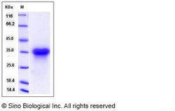 Sino Biological Recombinant Rat Lymphotoxin-beta receptor/TNFRSF3 Protein