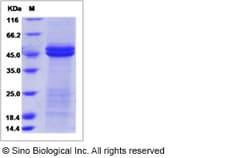 Sino Biological Rat IL-11RA1 / Il11RA1 Protein (His Tag) 200ug, Quantity: