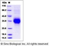 Sino Biological Rat TNFR1 / CD120a / TNFRSF1A Protein (His Tag) 100ug,
