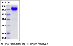 Sino Biological Recombinant Rat IL-10RB/IL-10R beta Protein (hFc Tag),