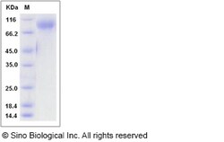 Sino Biological Recombinant Rat IL-13 R alpha 1/IL13RA1 Protein (hFc Tag),