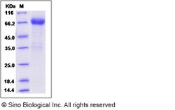 Sino Biological Recombinant Rat IL-21 Receptor/IL-21R Protein (mFc Tag),