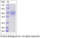 Sino Biological Recombinant Rat IL-21 Receptor/IL-21R Protein (His Tag),