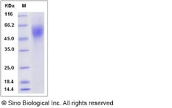 Sino Biological Recombinant Rat IL-17RA Protein (His Tag), Quantity: Each