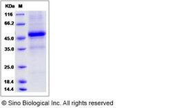 Sino Biological Recombinant Rat IL-25/IL-17E Protein (hFc Tag), Quantity: