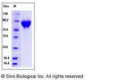Sino Biological Recombinant Rat IL1R2 Protein (His Tag), Quantity: Each