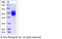 Sino Biological Recombinant Rat IL-2R gamma/CD132 Protein (His Tag), Quantity: