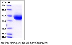 Sino Biological Recombinant Rat IL-4R Protein (His Tag), HPLC-verified,