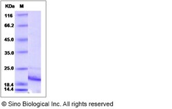 Sino Biological Rat IL21 / Interleukin 21 Protein (His Tag) 100ug, Quantity: