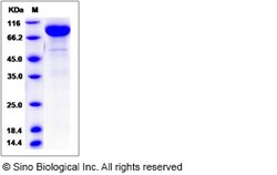 Sino Biological Rat IL13RA2 / IL13R Protein (Fc Tag) 100ug, Quantity: Each