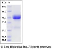 Sino Biological Rat IL13RA2 / IL13R Protein (His Tag) 100ug, Quantity: