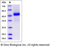 Sino Biological Recombinant Rat EDA2R/TNFRSF27 Protein (hFc Tag), Quantity: