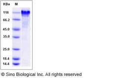 Sino Biological Recombinant Rat C1qR1/CD93 Protein (His Tag), HPLC-verified,