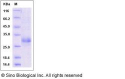 Sino Biological Recombinant Rat CLEC4D Protein (His Tag), Quantity: Each