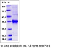 Sino Biological Recombinant Rat ASAM Protein (His Tag), Quantity: Each