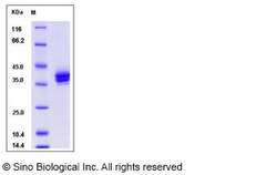 Sino Biological Rat CADM3 / NECL1 / IGSF4B Protein (His Tag) 100ug, Quantity: