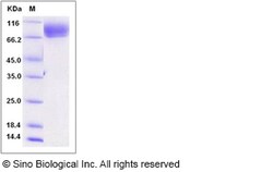 Sino Biological Recombinant Rat CD166/ALCAM Protein (His Tag), Quantity: