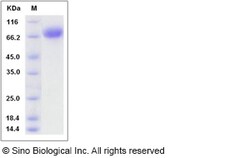 Sino Biological Rat BCAM Protein (His Tag) 100ug, Quantity: Each of 1