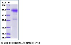 Sino Biological Recombinant Rat CD27/TNFRSF7 Protein (hFc Tag), Quantity: