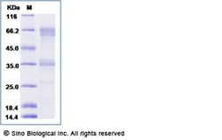 Sino Biological Recombinant Rat CD27/TNFRSF7 Protein (mFc Tag), Quantity: