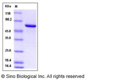 Sino Biological Rat Galectin-8 / LGALS8 Protein (GST Tag) 100ug, Quantity: