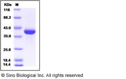 Sino Biological Rat MDHA / MDH1 Protein (His Tag) 50ug, Quantity: Each