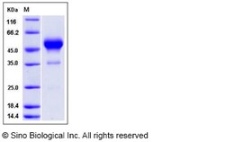 Sino Biological Recombinant Rat IFN gamma Protein (hFc Tag), Quantity: