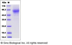 Sino Biological Recombinant Rat HEPACAM2 Protein (His Tag), Quantity: Each