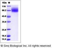 Sino Biological Recombinant Rat TrkB Protein (His Tag), Quantity: Each
