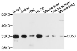 ABclonal Technology CD53 Polyclonal Antibody, 100UL, Validated in:WB, Quantity:
