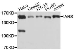 ABclonal Technology IARS Polyclonal Antibody, 100UL, Validated in:WB, IHC,