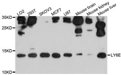 ABclonal Technology LY6E Polyclonal Antibody, 100UL, Validated in:WB, Quantity: